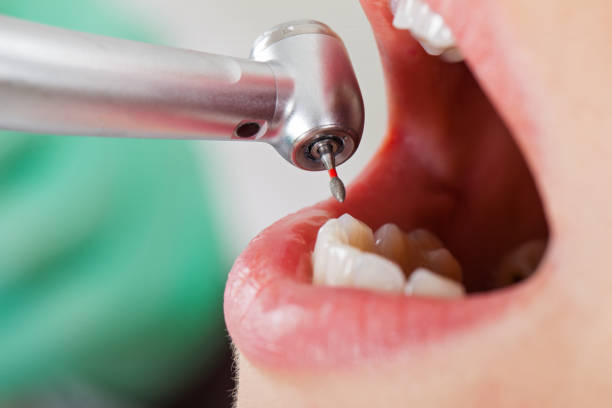 Best Dentist for Tooth Abscess  in Walden, TN